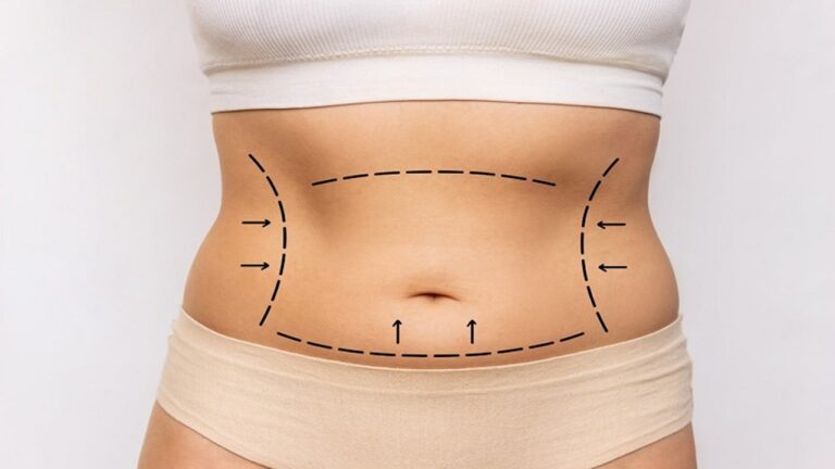 Liposuction Yatırımınız: Daha Şekilli Bir Vücuda Ulaşmanın Bedeli