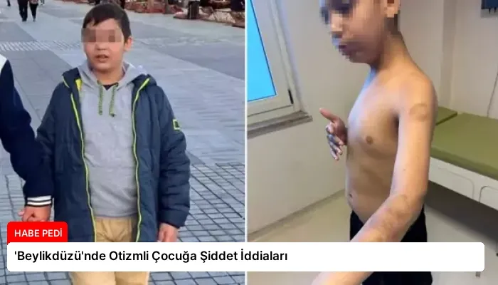 ‘Beylikdüzü’nde Otizmli Çocuğa Şiddet İddiaları