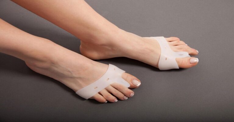 Halluks Valgus Ameliyatı