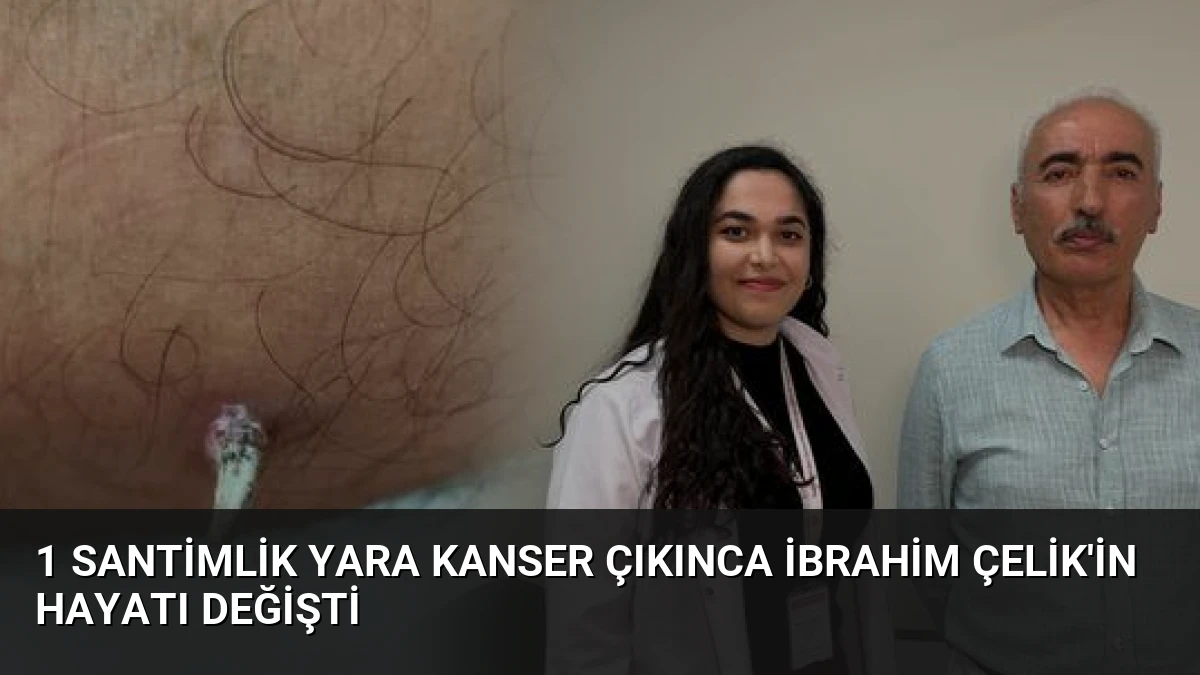 1 Santimlik Yara Kanser Çıkınca İbrahim Çelik’in Hayatı Değişti