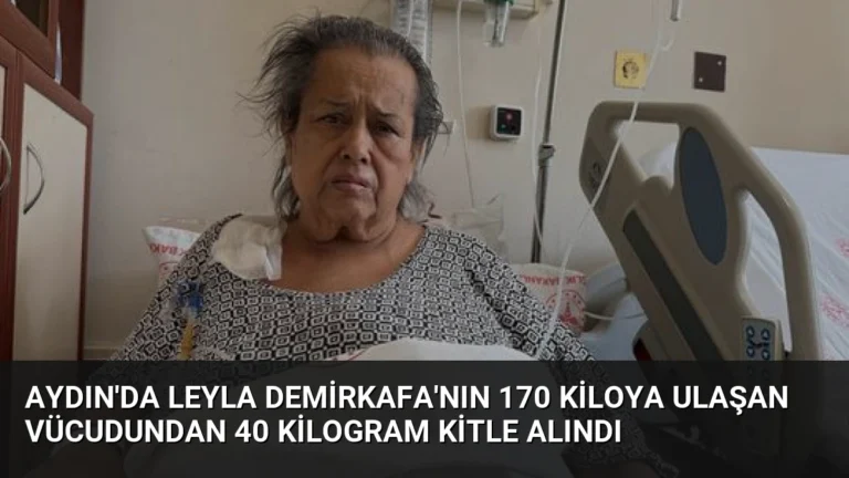 Aydın’da Leyla Demirkafa’nın 170 Kiloya Ulaşan Vücudundan 40 Kilogram Kitle Alındı