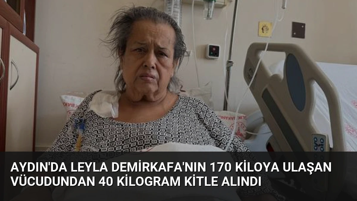 Aydın’da Leyla Demirkafa’nın 170 Kiloya Ulaşan Vücudundan 40 Kilogram Kitle Alındı