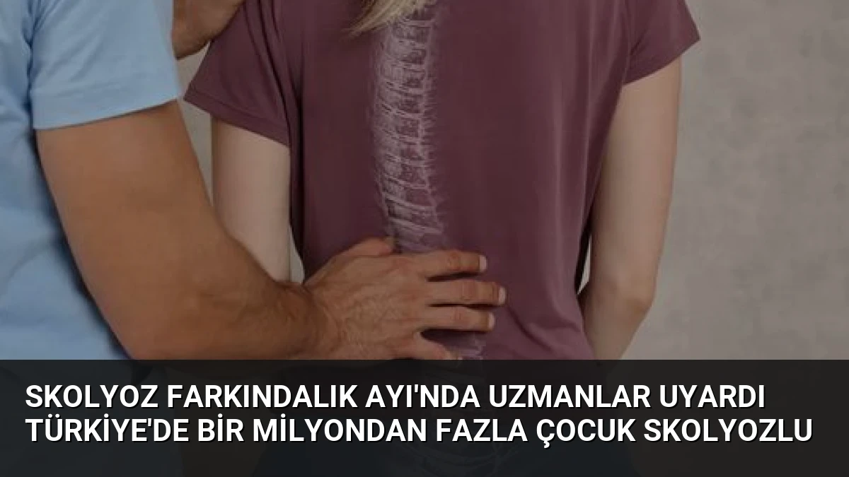 Skolyoz Farkındalık Ayı’nda Uzmanlar Uyardı Türkiye’de Bir Milyondan Fazla Çocuk Skolyozlu