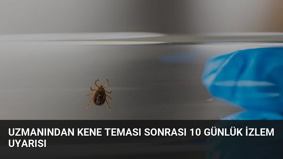 Uzmanından Kene Teması Sonrası 10 Günlük İzlem Uyarısı