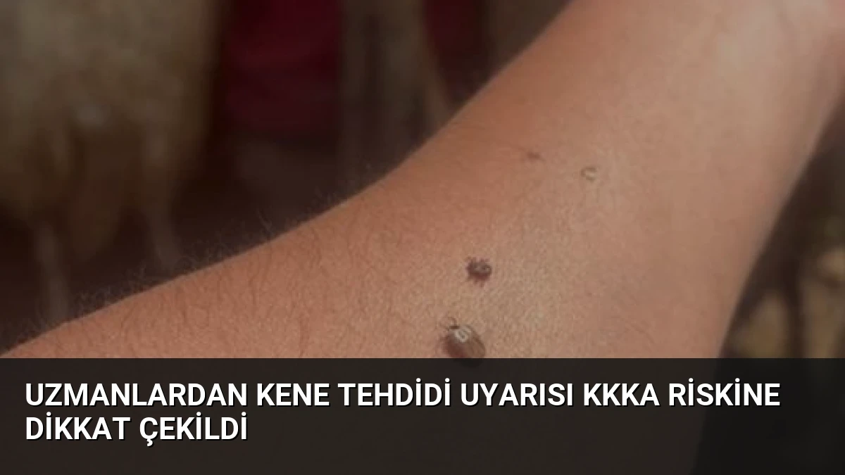 Uzmanlardan Kene Tehdidi Uyarısı KKKA Riskine Dikkat Çekildi