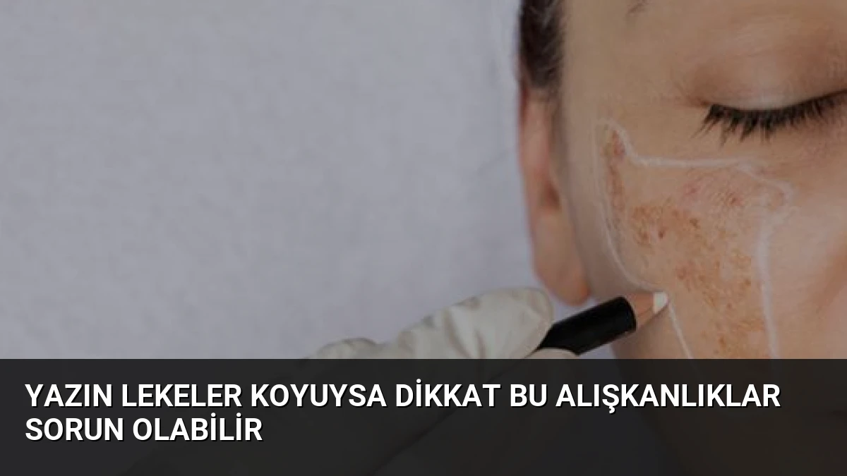 Yazın Lekeler Koyuysa Dikkat Bu Alışkanlıklar Sorun Olabilir