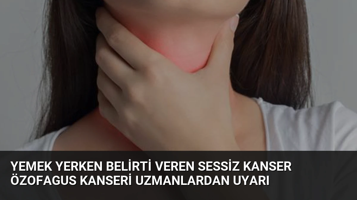 Yemek Yerken Belirti Veren Sessiz Kanser Özofagus Kanseri Uzmanlardan Uyarı