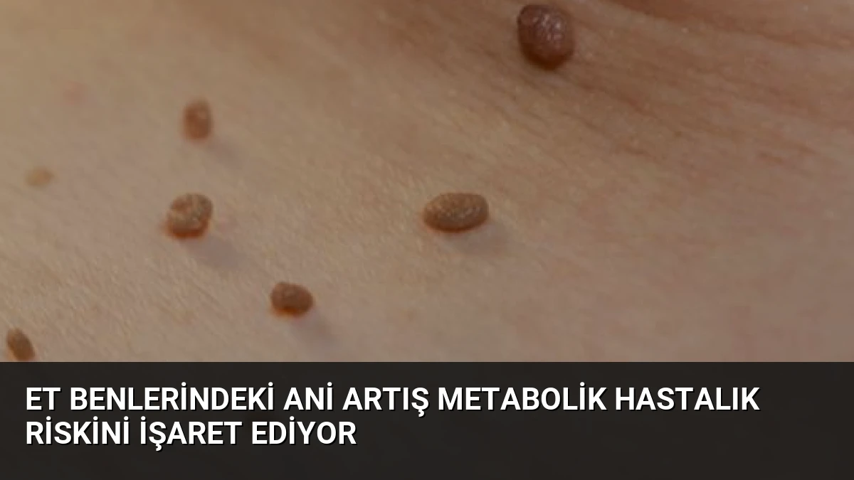 Et Benlerindeki Ani Artış Metabolik Hastalık Riskini İşaret Ediyor