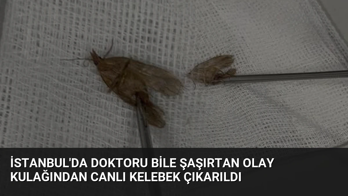İstanbul’da Doktoru Bile Şaşırtan Olay Kulağından Canlı Kelebek Çıkarıldı