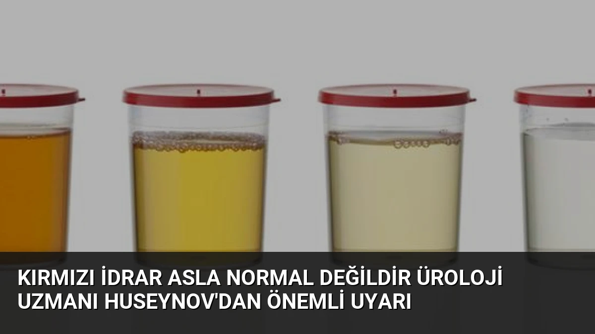 Kırmızı İdrar Asla Normal Değildir Üroloji Uzmanı Huseynov’dan Önemli Uyarı