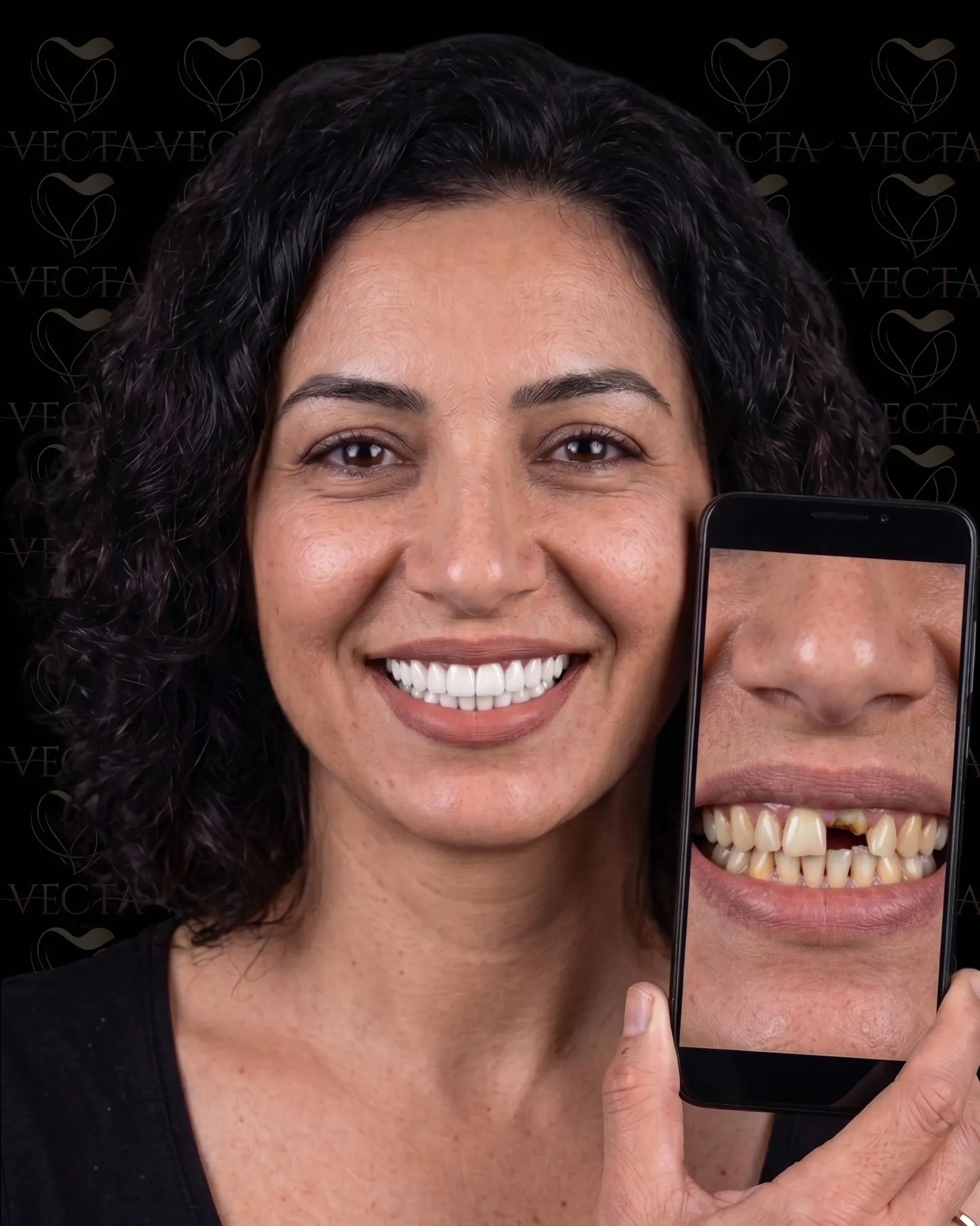 Yeni Bir Gülüş, Güçlü Yarınlar: Vecta Dental Clinic İmplant Tedavileri