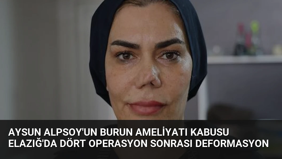 Aysun Alpsoy’un Burun Ameliyatı Kabusu Elazığ’da Dört Operasyon Sonrası Deformasyon