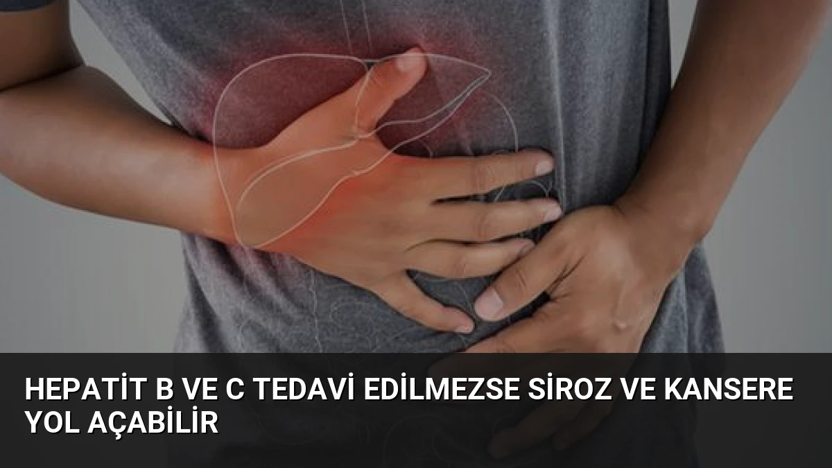 Hepatit B ve C Tedavi Edilmezse Siroz ve Kansere Yol Açabilir