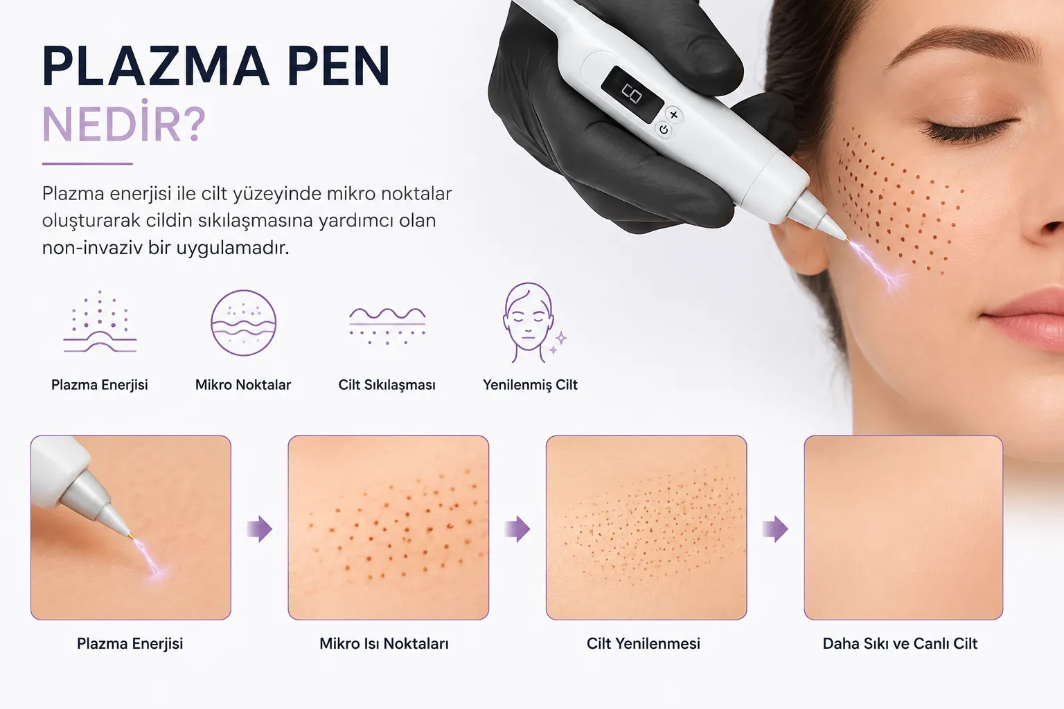 Plazma Pen Nedir? Çalışma Prensibi ve Kullanım Alanları