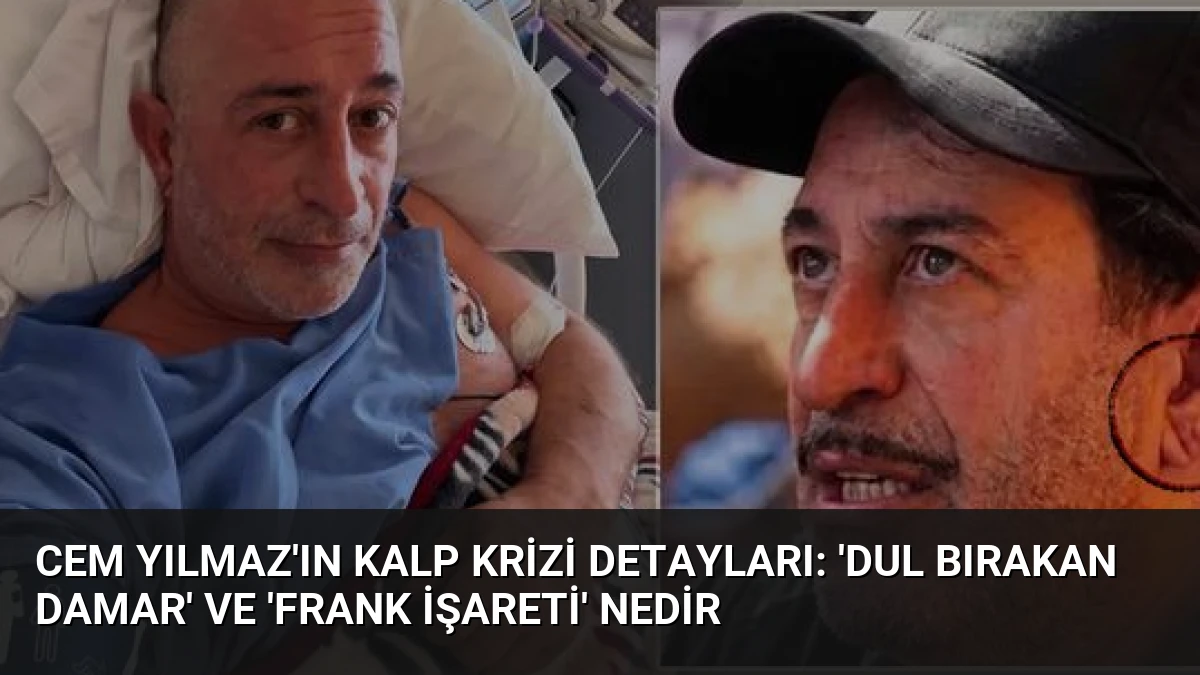 Cem Yılmaz’ın Kalp Krizi Detayları: ‘Dul Bırakan Damar’ ve ‘Frank İşareti’ Nedir