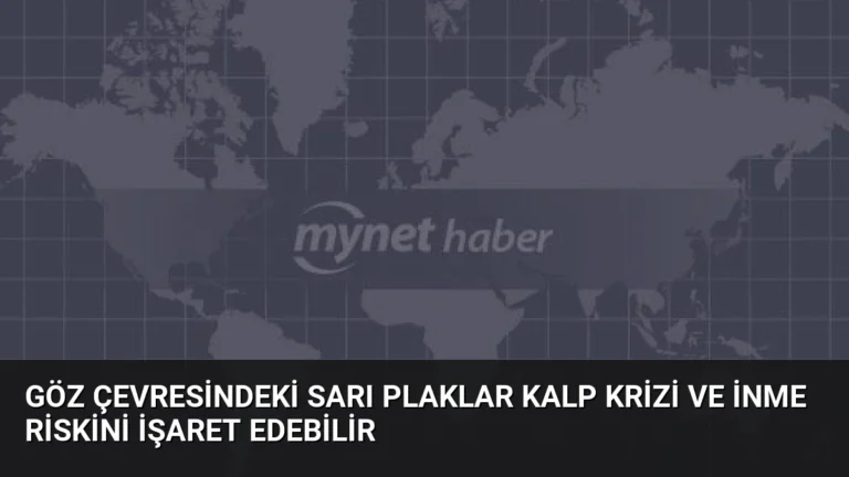 Göz Çevresindeki Sarı Plaklar Kalp Krizi ve İnme Riskini İşaret Edebilir