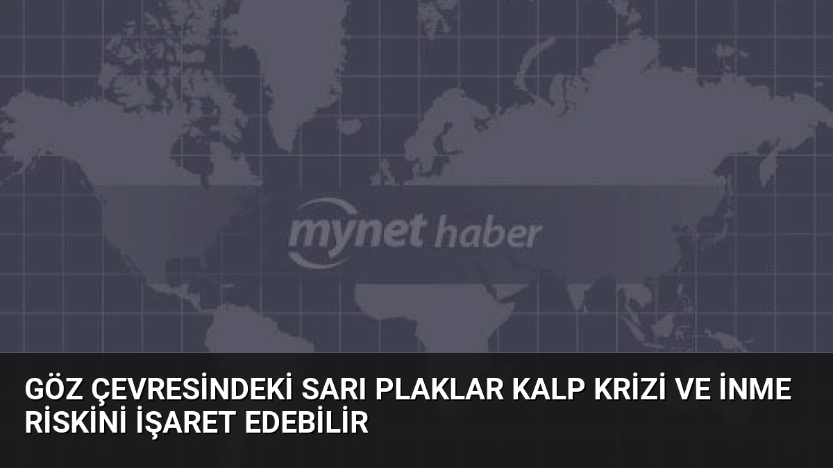 Göz Çevresindeki Sarı Plaklar Kalp Krizi ve İnme Riskini İşaret Edebilir