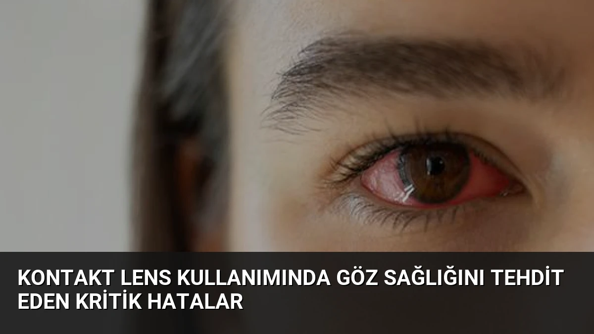 Kontakt Lens Kullanımında Göz Sağlığını Tehdit Eden Kritik Hatalar
