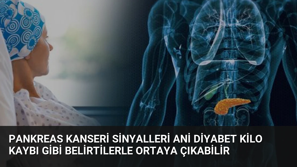 Pankreas Kanseri Sinyalleri Ani Diyabet Kilo Kaybı Gibi Belirtilerle Ortaya Çıkabilir