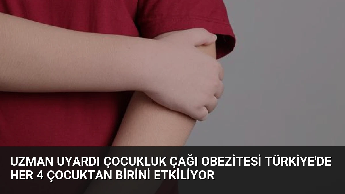 Uzman Uyardı Çocukluk Çağı Obezitesi Türkiye’de Her 4 Çocuktan Birini Etkiliyor