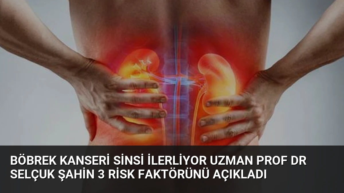 Böbrek Kanseri Sinsi İlerliyor Uzman Prof Dr Selçuk Şahin 3 Risk Faktörünü Açıkladı