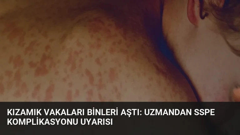 Kızamık Vakaları Binleri Aştı: Uzmandan SSPE Komplikasyonu Uyarısı
