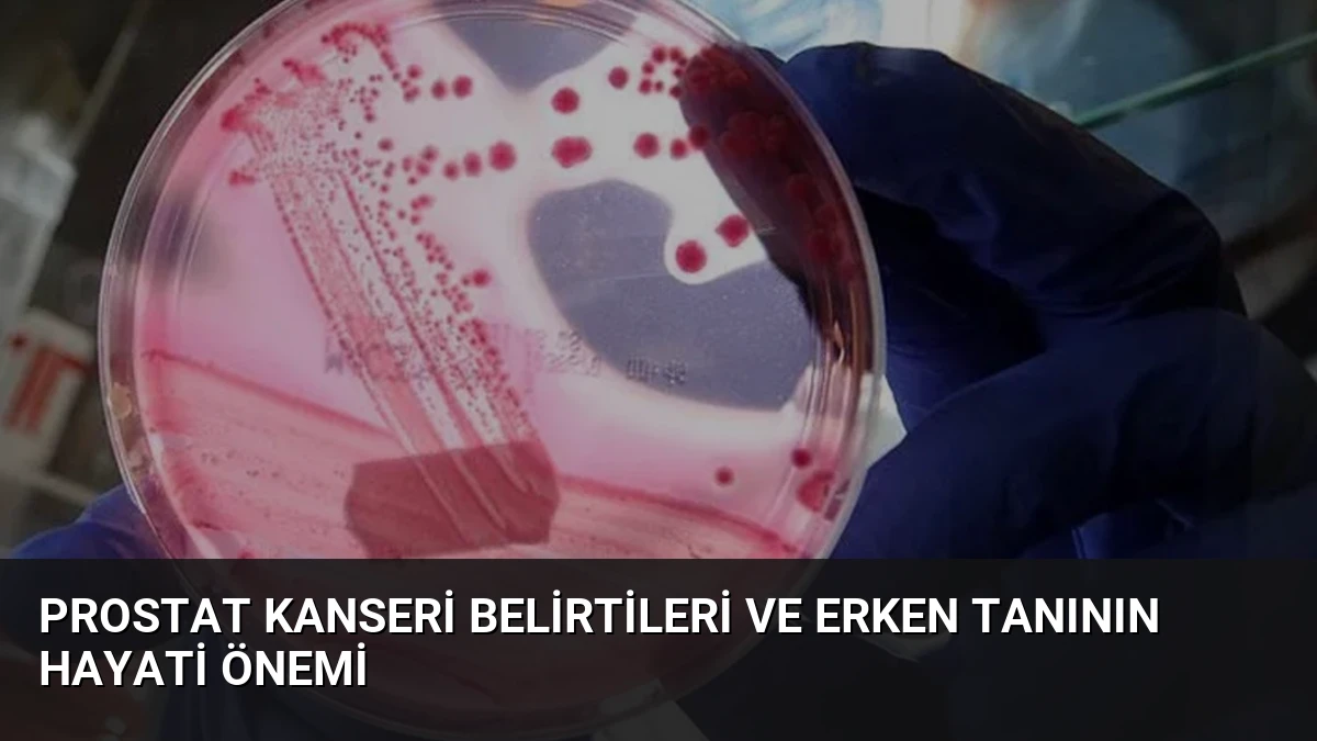 Prostat Kanseri Belirtileri ve Erken Tanının Hayati Önemi