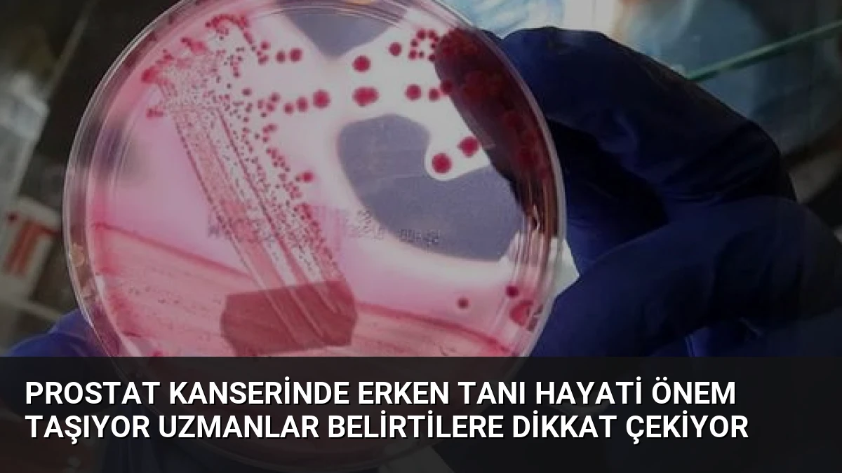 Prostat Kanserinde Erken Tanı Hayati Önem Taşıyor Uzmanlar Belirtilere Dikkat Çekiyor